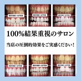 ホワイトニングサロン 豊中