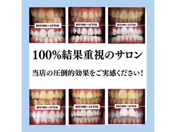 ホワイトニングサロン 豊中