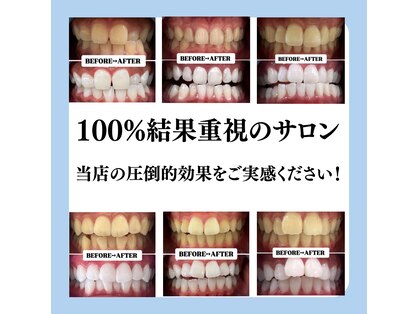 ホワイトニングサロン 豊中の写真