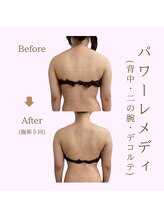 ルア(LuA.)/パワーレメディ◎