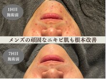 男性のお客様も気軽に通っていただけるサロンです！