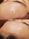 グリッター(Glitter)の写真/眉毛だけでなくお顔全体の脱毛に◎フェイシャルワックスで産毛まですっきり除去≪綺麗な美眉×美顔脱毛≫
