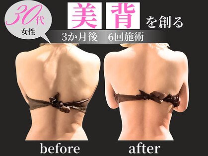 ノーブルノアール(Noble noir)の写真