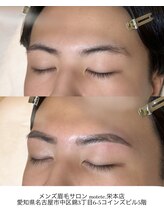 モテテ(motete)/お客様施術例☆栄本店