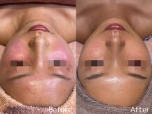 ビューティーサロンリア 栄 伏見店(LI'A)の雰囲気(【赤み/乾燥/肌荒れ】肌質改善症例写真はフォトギャラリーへ)