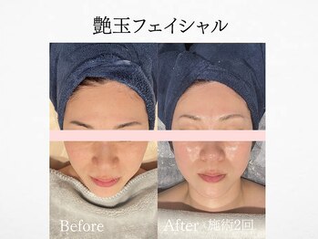 アンドミルル(and Milulu)/【韓国艶肌フェイシャル】