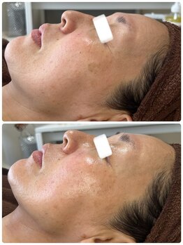 トイボーテ(toi beaute)/アラフォーになったら月一ケア！