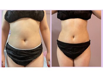 ウィステリア(WISTERIA)/モニター様結果