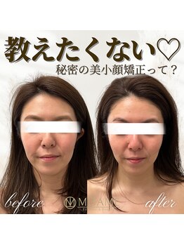 ミタメ 銀座店(MITAME)/芸能人もお忍びで通う美小顔矯正