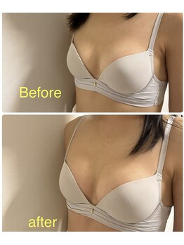 ベッピン(Beppin)/静岡バストケア/静岡育乳