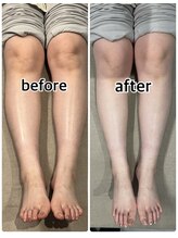 クロムネイル(CHROMNAIL)/リフレクソロジー