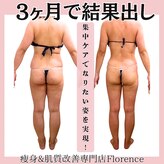 フローレンス(Florence)