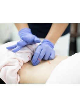 鍼灸施術を受けたい