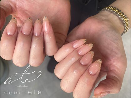 テテ(tete)の写真