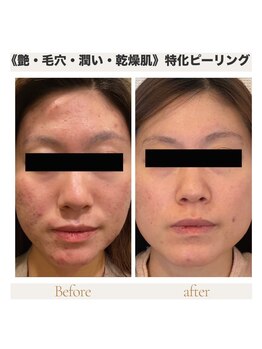 カナウ produced by きょうわ整体院(Kanau.)/《艶・毛穴・うるおい・乾燥肌》