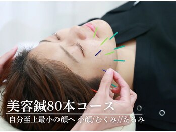 アロエベル(aloe Belle)/美容鍼