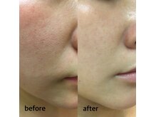 エメトワ(Aimetoi)の雰囲気(毛穴の目立たない滑らかで透明感のある素肌に。)