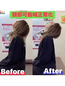 ヒデ整体院(Hide整体院)/産後骨盤矯正で歪み腰痛開き改善