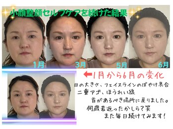 Rらっくす/小顔セルフケア指導