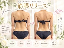 リンパサロンナチュレール (naturel)の雰囲気（美姿勢◎ まき肩・猫背/歪み/産後骨盤矯正/関節の可動域に！）