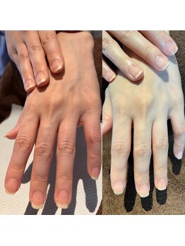 トゥルーケア(TRUE CARE)/ハンドネイルケア