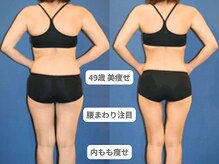 アンシャンテ 神戸元町店(Enchante)/痩身ダイエット　神戸元町三ノ宮