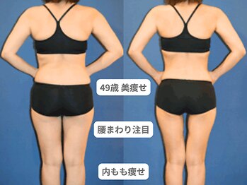 アンシャンテ 神戸元町店(Enchante)/痩身ダイエット　神戸元町三ノ宮