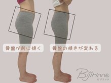 ビジリンヌ/姿勢改善　骨盤矯正