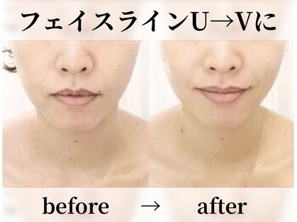 ガーデン(Garden)の写真