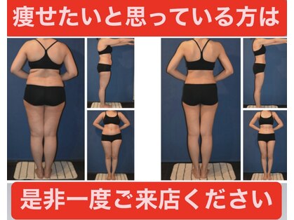 フェムプリュ(femplus)の写真