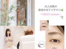 トリート アイラッシュ(TREAT eyelash)