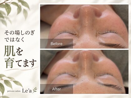 レア(Le'a)の写真