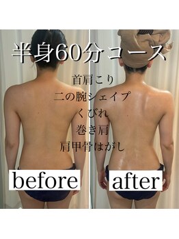 グランドシャルムエス(Grand Charme S)/南森町/上半身痩せ/ブライダル