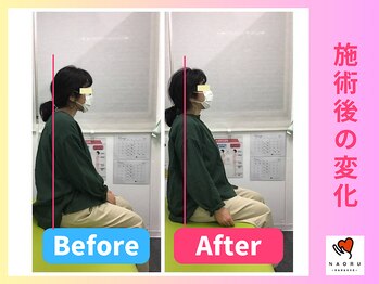 ナオル整体 川越院(NAORU整体)/猫背姿勢が改善【整体/矯正】
