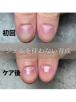 ケアでもここまで整う