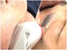 アイブロウデザイン脱毛&メンズ全顔♪¥12,000