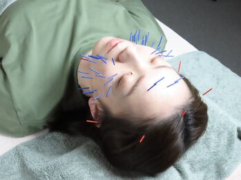 てと整体院/☆美容鍼☆