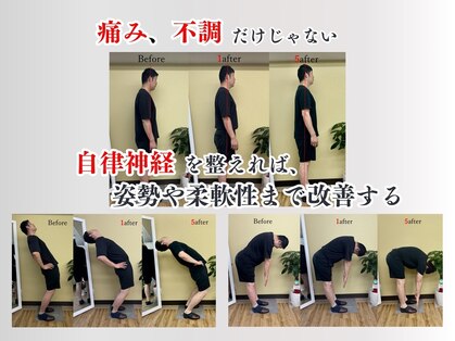アプロ(APLO)の写真