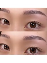 ヴィフ(Vif)/ハリウッドブロウリフト