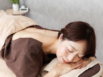 プライムライフ(prime-life)/贅沢鍼灸・美容鍼で至福の時間を