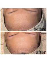 ディオーネ 春日井勝川店(Dione)/マーメイドセルトリートメント