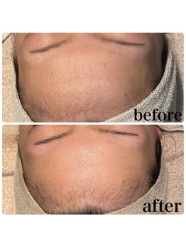 ディオーネ 春日井勝川店(Dione)/マーメイドセルトリートメント