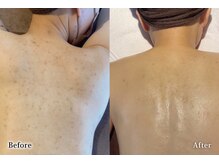 アネル 美里店(anel)/背中改善プログラムで綺麗に