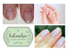 カランコエ(Kalanchoe)