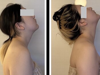 ビパール(bea pull)/ヘッドスパ　ストレートネック