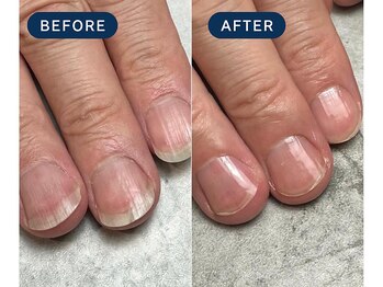 マニネイルケア 西船橋店(maninail CARE)/ネイルケア