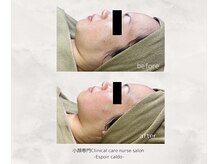 エスポワールカルド(Espoir caldo)/