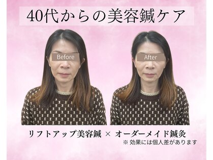 望鍼灸院の写真