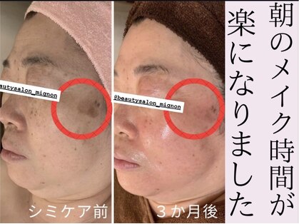 ミニョン(Mignon)の写真