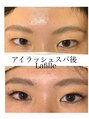 ラフィーユ 宜野湾店(Lafille) アイスパでまつげが太く長く目のクマむくみ効果実感※1回施術
